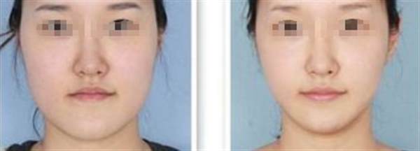 <a href=http://www.f3bb6.cn/listinfo-631-0.html target=_blank class=infotextkey>瘦臉</a>好方法