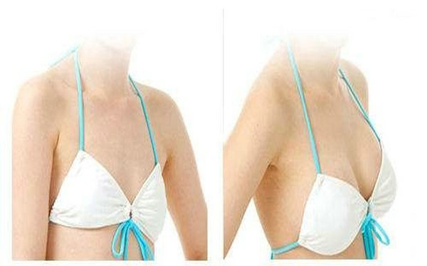 假體<a href=http://www.f3bb6.cn/listinfo-618-0.html target=_blank class=infotextkey>隆胸</a>答疑解惑