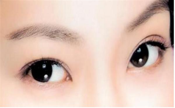 上臉下垂矯正術多少錢