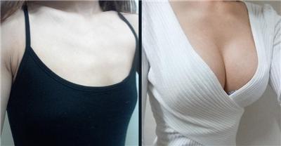 成都<a href=http://www.f3bb6.cn/listinfo-618-0.html target=_blank class=infotextkey>隆胸</a>禁忌人群有哪些