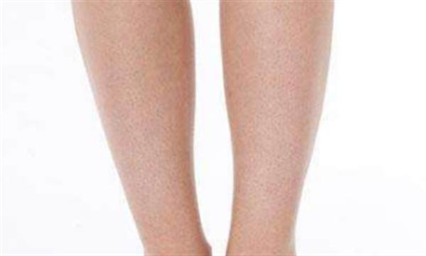 <a href=http://www.f3bb6.cn/listinfo-670-0.html target=_blank class=infotextkey>脫毛</a>方法較好的是一種