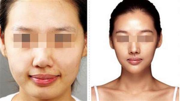 <a href=http://www.f3bb6.cn/listinfo-631-0.html target=_blank class=infotextkey>瘦臉</a><a href=http://www.f3bb6.cn/listinfo-614-0.html target=_blank class=infotextkey>除皺</a>多少錢