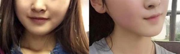 臉太胖了怎么能瘦下來