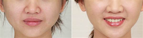 人很<a href=http://www.f3bb6.cn/listinfo-631-0.html target=_blank class=infotextkey>瘦臉</a>很胖怎么辦