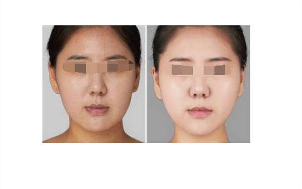 廣州彩光<a href=http://www.f3bb6.cn/listinfo-763-0.html target=_blank class=infotextkey><a href=http://www.f3bb6.cn/listinfo-770-0.html target=_blank class=infotextkey>嫩膚</a>美白</a>后的護理要注意什么