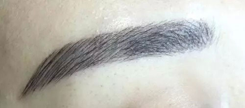  做眉毛發(fā)炎了幾天能好