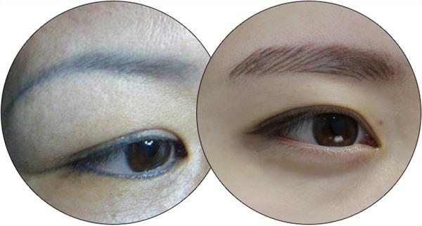 紋眉發炎影響上色嗎