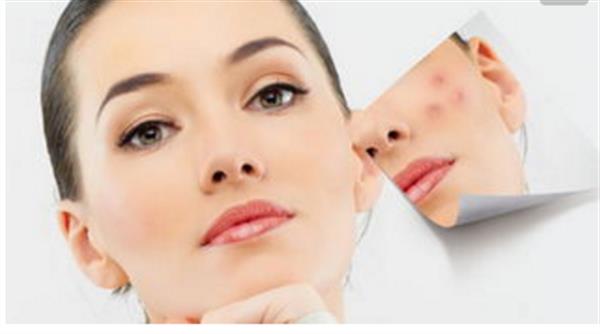 激光可以去除疤痕嗎