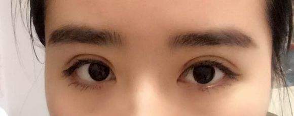 韓式精切是長期的嗎