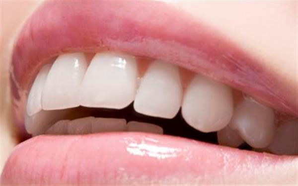 隱形矯正的過程是怎樣的呢