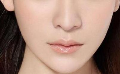 廣州假體墊下巴有哪些優勢