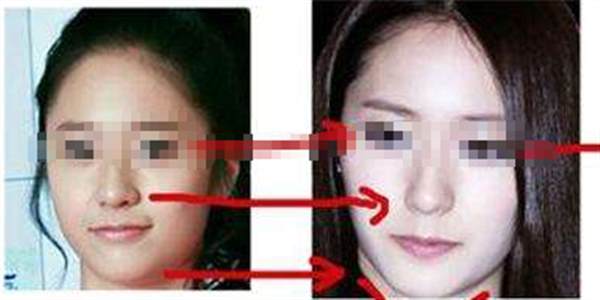 方形臉骨骼大怎么<a href=http://www.f3bb6.cn/listinfo-631-0.html target=_blank class=infotextkey>瘦臉</a>