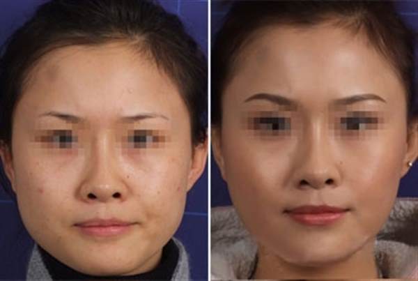 <a href=http://www.f3bb6.cn/listinfo-631-0.html target=_blank class=infotextkey>瘦臉</a><a href=http://www.f3bb6.cn/listinfo-614-0.html target=_blank class=infotextkey>除皺</a>多少錢一次合肥