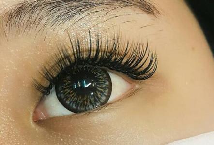 開(kāi)內(nèi)眼角術(shù)后應(yīng)該如何護(hù)理