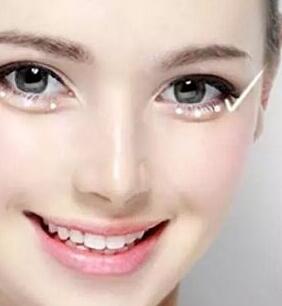 豐<a href=http://www.f3bb6.cn/listinfo-722-0.html target=_blank class=infotextkey>臥蠶</a>術前注意事項