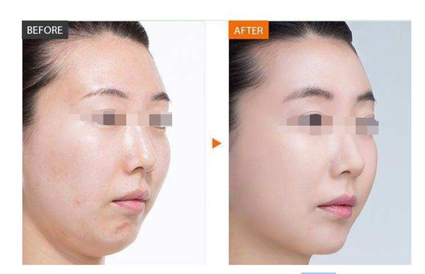 做彩光<a href=http://www.f3bb6.cn/listinfo-770-0.html target=_blank class=infotextkey>嫩膚</a>美容手術有哪些好處呢