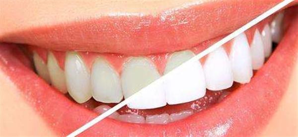 <a href=http://www.f3bb6.cn/listinfo-825-0.html target=_blank class=infotextkey>牙齒種植</a>手術需要住院嗎