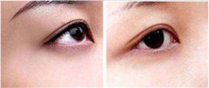 如何<a href=http://www.f3bb6.cn/listinfo-712-0.html target=_blank class=infotextkey>洗眼線</a>