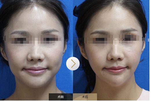 <a href=http://www.f3bb6.cn/listinfo-631-0.html target=_blank class=infotextkey>瘦臉</a><a href=http://www.f3bb6.cn/listinfo-614-0.html target=_blank class=infotextkey>除皺</a>多少錢一次