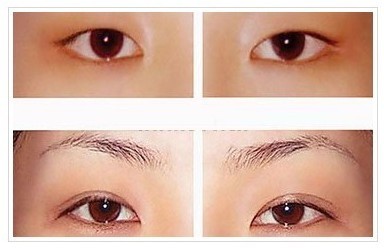 <a href=http://www.f3bb6.cn/listinfo-711-0.html target=_blank class=infotextkey>開眼角</a>一個月能完全修復嗎