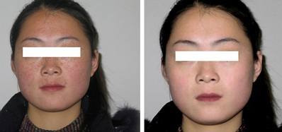 彩光<a href=http://www.f3bb6.cn/listinfo-763-0.html target=_blank class=infotextkey><a href=http://www.f3bb6.cn/listinfo-770-0.html target=_blank class=infotextkey>嫩膚</a>美白</a>的原理是什么