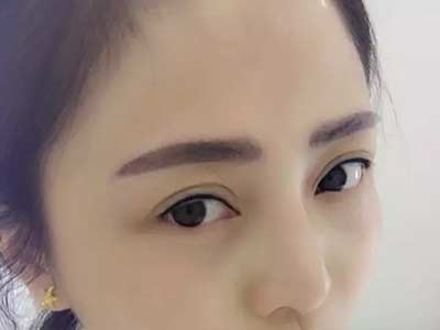 <a href=http://www.f3bb6.cn/listinfo-714-0.html target=_blank class=infotextkey>紋眼線</a>眼睛一般腫幾天