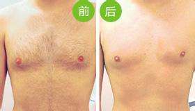 <a href=http://www.f3bb6.cn/listinfo-670-0.html target=_blank class=infotextkey>脫毛</a>到底哪種方法好