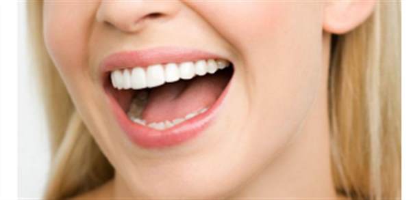 牙齒貼面要多久