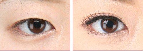 割<a href=http://www.f3bb6.cn/listinfo-724-0.html target=_blank class=infotextkey>雙眼皮</a>手術平行和扇形哪種好