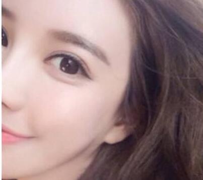 <a href=http://www.f3bb6.cn/listinfo-690-0.html target=_blank class=infotextkey>自體脂肪填充</a>蘋果肌多少錢