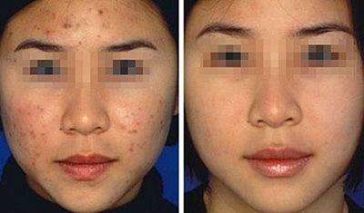 請(qǐng)問<a href=http://www.f3bb6.cn/listinfo-730-0.html target=_blank class=infotextkey>黑臉娃娃</a>可以祛皺<a href=http://www.f3bb6.cn/listinfo-795-0.html target=_blank class=infotextkey>祛斑</a>嗎