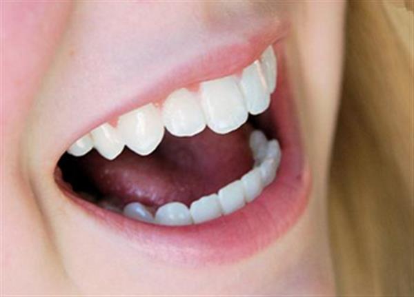 無鈹<a href=http://www.f3bb6.cn/listinfo-829-0.html target=_blank class=infotextkey>烤瓷牙</a>術前注意事項