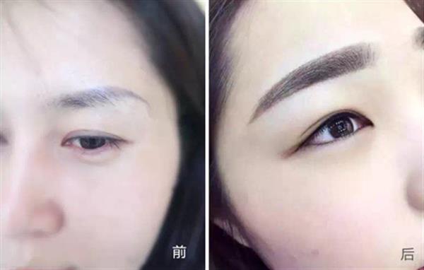 <a href=http://www.f3bb6.cn/listinfo-657-0.html target=_blank class=infotextkey>繡眉</a>毛后幾天可以洗臉