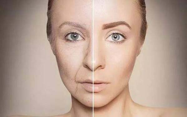 光子<a href=http://www.f3bb6.cn/listinfo-770-0.html target=_blank class=infotextkey>嫩膚</a>反黑能恢復嗎