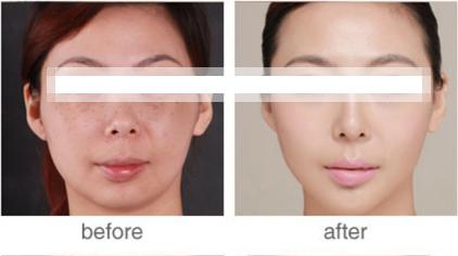 怎樣<a href=http://www.f3bb6.cn/listinfo-795-0.html target=_blank class=infotextkey>祛斑</a>