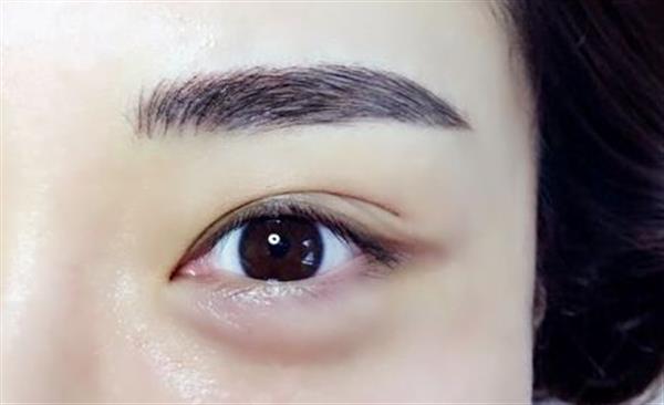 <a href=http://www.f3bb6.cn/listinfo-655-0.html target=_blank class=infotextkey>切眉</a>和提眉的區別