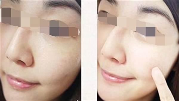 光子<a href=http://www.f3bb6.cn/listinfo-770-0.html target=_blank class=infotextkey>嫩膚</a>美容的原理