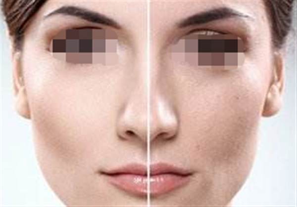 彩光<a href=http://www.f3bb6.cn/listinfo-770-0.html target=_blank class=infotextkey>嫩膚</a>后的注意事項有哪些