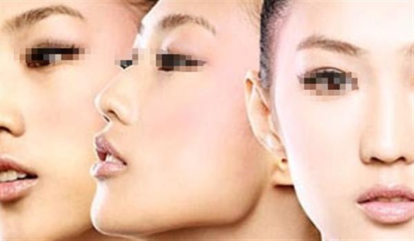 哪些人不適合進行光子<a href=http://www.f3bb6.cn/listinfo-770-0.html target=_blank class=infotextkey>嫩膚</a>