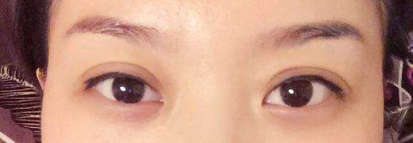 焊接<a href=http://www.f3bb6.cn/listinfo-724-0.html target=_blank class=infotextkey>雙眼皮</a>有什么缺點