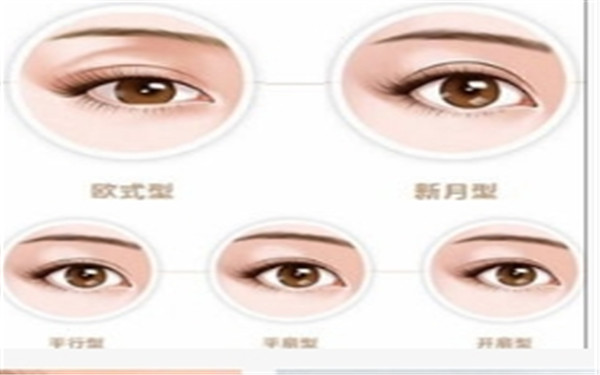  <a href=http://www.f3bb6.cn/listinfo-724-0.html target=_blank class=infotextkey>雙眼皮</a>修復有哪些原則