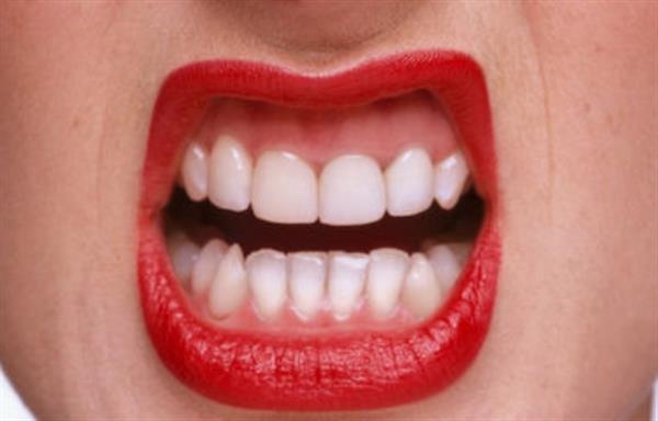 種植牙適合人群多嗎