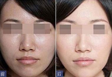 水光<a href=http://www.f3bb6.cn/listinfo-770-0.html target=_blank class=infotextkey>嫩膚</a>反黑多久能恢復