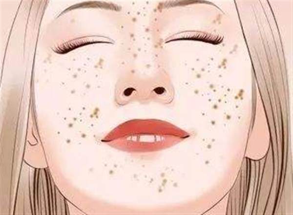 深圳剝脫治療<a href=http://www.f3bb6.cn/listinfo-774-0.html target=_blank class=infotextkey>去雀斑</a>哪個醫院好