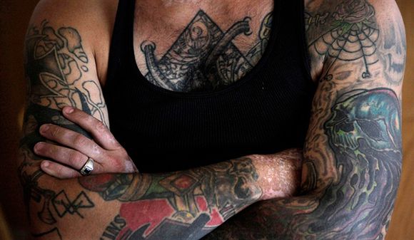 紋身植皮手術后恢復圖好不好