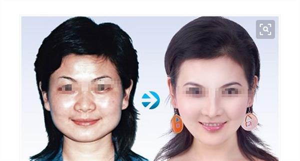 彩光<a href=http://www.f3bb6.cn/listinfo-770-0.html target=_blank class=infotextkey>嫩膚</a>手術的優點有哪些呢