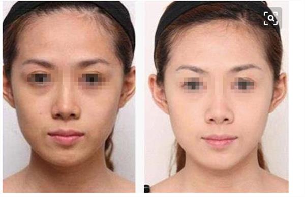 彩光<a href=http://www.f3bb6.cn/listinfo-763-0.html target=_blank class=infotextkey><a href=http://www.f3bb6.cn/listinfo-770-0.html target=_blank class=infotextkey>嫩膚</a>美白</a>后要如何護理