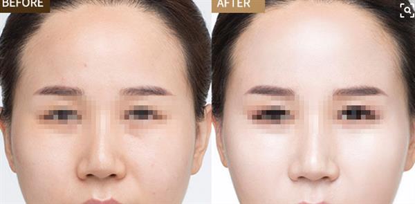 彩光<a href=http://www.f3bb6.cn/listinfo-770-0.html target=_blank class=infotextkey>嫩膚</a>的優點有哪些