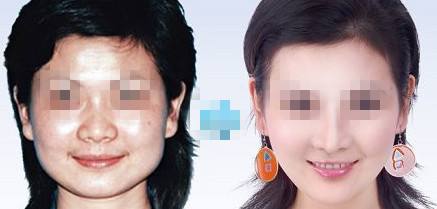 光子<a href=http://www.f3bb6.cn/listinfo-770-0.html target=_blank class=infotextkey>嫩膚</a>的危害、缺陷