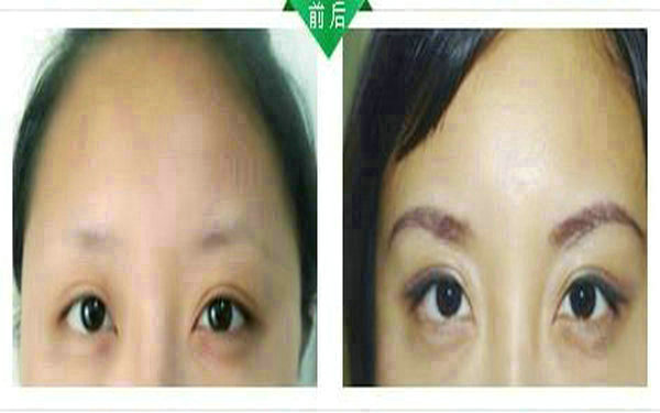 <a href=http://www.f3bb6.cn/listinfo-655-0.html target=_blank class=infotextkey>切眉</a>多久可以<a href=http://www.f3bb6.cn/listinfo-657-0.html target=_blank class=infotextkey>繡眉</a>?